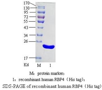 视黄醇结合蛋白4 ( RBP4 )